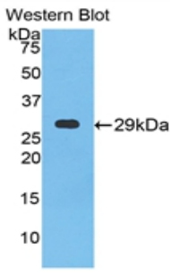 NPTX1 Antibody - Western blot of recombinant NPTX1 / NP1.  This image was taken for the unconjugated form of this product. Other forms have not been tested.