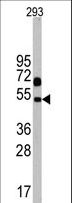 NPTX1 Antibody - Western blot of Nptx1 Antibody in 293 cell line lysates (35 ug/lane). Nptx1 (arrow) was detected using the purified antibody.