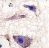 NPTX1 Antibody - Formalin-fixed and paraffin-embedded human brain tissue reacted with Nptx1 Antibody , which was peroxidase-conjugated to the secondary antibody, followed by DAB staining. This data demonstrates the use of this antibody for immunohistochemistry; clinical relevance has not been evaluated.