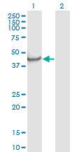 NPTX1 Antibody - Western Blot analysis of NPTX1 expression in transfected 293T cell line by NPTX1 monoclonal antibody (M06), clone 7E6.Lane 1: NPTX1 transfected lysate (Predicted MW: 47.52 KDa).Lane 2: Non-transfected lysate.