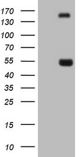 NPTX1 Antibody - HEK293T cells were transfected with the pCMV6-ENTRY control (Left lane) or pCMV6-ENTRY NPTX1 (Right lane) cDNA for 48 hrs and lysed. Equivalent amounts of cell lysates (5 ug per lane) were separated by SDS-PAGE and immunoblotted with anti-NPTX1.