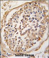 NPTX2 Antibody - Formalin-fixed and paraffin-embedded human testis tissue reacted with NARP (Nptx2) Antibody (Center) , which was peroxidase-conjugated to the secondary antibody, followed by DAB staining. This data demonstrates the use of this antibody for immunohistochemistry; clinical relevance has not been evaluated.