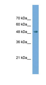 NPTX2 Antibody - NPTX2 antibody Western blot of Transfected 293T cell lysate. This image was taken for the unconjugated form of this product. Other forms have not been tested.