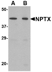 NPTX2 Antibody - Western blot of NPTX2 in mouse brain tissue lysate with NPTX2 antibody at (A) 0.5 and (B) 1 ug/ml.