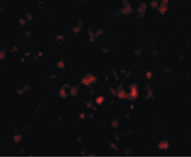 NPTX2 Antibody - Immunofluorescence of NPTX2 in Human Brain cells with NPTX2 antibody at 20 ug/ml.