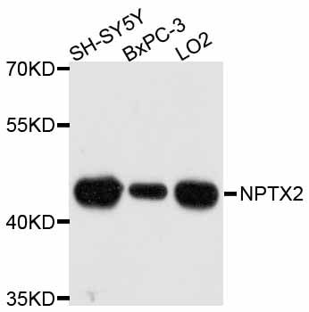 NPTX2 Antibody - Western blot analysis of extracts of various cell lines, using NPTX2 antibody at 1:3000 dilution. The secondary antibody used was an HRP Goat Anti-Rabbit IgG (H+L) at 1:10000 dilution. Lysates were loaded 25ug per lane and 3% nonfat dry milk in TBST was used for blocking. An ECL Kit was used for detection and the exposure time was 60s.