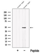 NPTX2 Antibody - Western blot analysis of extracts of mouse brain tissue using NPTX2 antibody. The lane on the left was treated with blocking peptide.