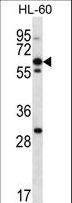 NPTXR / NPR Antibody - NPTXR Antibody western blot of HL-60 cell line lysates (35 ug/lane). The NPTXR antibody detected the NPTXR protein (arrow).