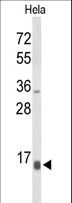 NPW Antibody - Western blot of NPW Antibody in HeLa cell line lysates (35 ug/lane). NPW (arrow) was detected using the purified antibody.