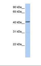 NPY1R Antibody - Fetal brain lysate. Antibody concentration: 1.0 ug/ml. Gel concentration: 12%.  This image was taken for the unconjugated form of this product. Other forms have not been tested.