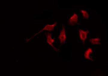 NPY1R Antibody - Staining NIH-3T3 cells by IF/ICC. The samples were fixed with PFA and permeabilized in 0.1% Triton X-100, then blocked in 10% serum for 45 min at 25°C. The primary antibody was diluted at 1:200 and incubated with the sample for 1 hour at 37°C. An Alexa Fluor 594 conjugated goat anti-rabbit IgG (H+L) Ab, diluted at 1/600, was used as the secondary antibody.