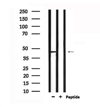NPY1R Antibody - Western blot analysis of extracts of mouse brain tissue using NPY1R antibody.