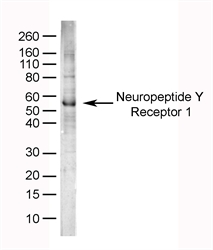 NPY1R Antibody - Human brain lysate probed with Sheep anti-Human Neuropeptide Y Receptor 1 (SHEEP ANTI HUMAN NEUROPEPTIDE Y RECEPTOR 1).