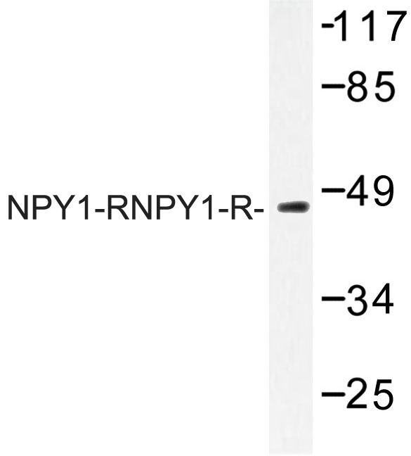NPY1R Antibody - Western blot of NPY1-R (R254) pAb in extracts from NIH-3T3 cells.