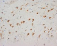 NPY1R Antibody -  This image was taken for the unconjugated form of this product. Other forms have not been tested.