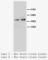 NPY1R Antibody -  This image was taken for the unconjugated form of this product. Other forms have not been tested.