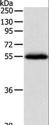 NPY1R Antibody - Western blot analysis of Human leiomyosarcoma tissue, using NPY1R Polyclonal Antibody at dilution of 1:400.
