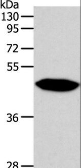 NPY1R Antibody - Western blot analysis of Human fetal brain tissue, using NPY1R Polyclonal Antibody at dilution of 1:500.