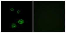 NPY2R Antibody - Immunofluorescence analysis of A549 cells, using NPY2R Antibody. The picture on the right is blocked with the synthesized peptide.