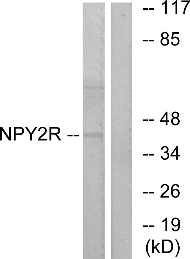 NPY2R Antibody - Western blot analysis of lysates from HepG2 cells, using NPY2R Antibody. The lane on the right is blocked with the synthesized peptide.