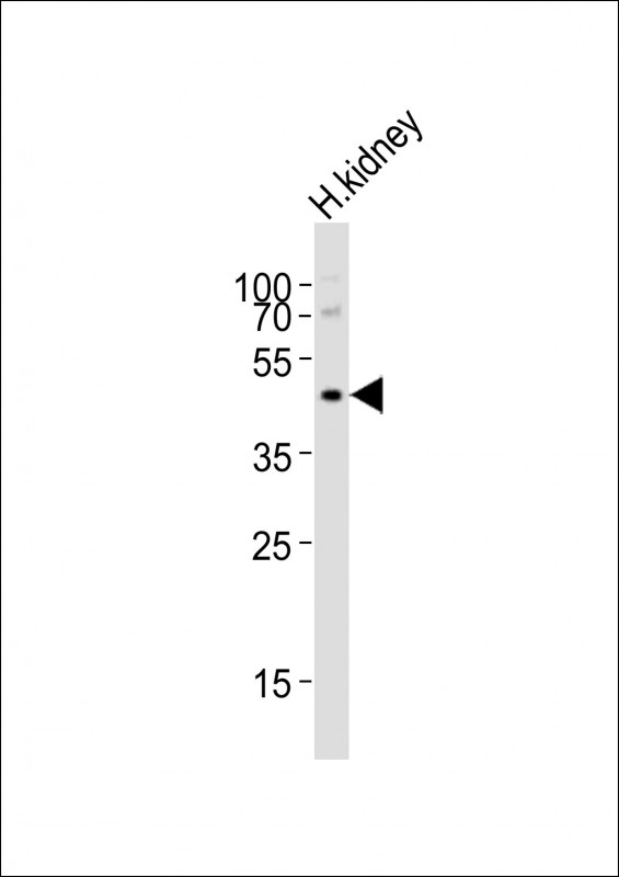 NPY2R Antibody - Anti-NPY2R Antibody at 1:1000 dilution + human kidney lysates Lysates/proteins at 20 ug per lane. Secondary Goat Anti-Rabbit IgG, (H+L), Peroxidase conjugated at 1/10000 dilution Predicted band size : 43 kDa Blocking/Dilution buffer: 5% NFDM/TBST.