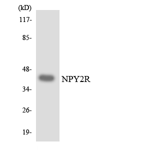 NPY2R Antibody - Western blot analysis of the lysates from HUVECcells using NPY2R antibody.