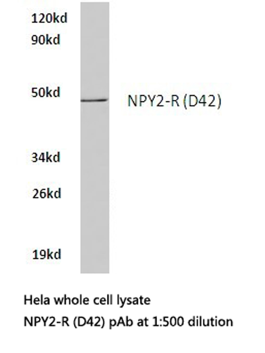 NPY2R Antibody - Western blot of NPY2-R (D42) pAb in extracts from HeLa cells.