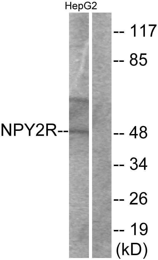 NPY2R Antibody - Western blot analysis of extracts from HepG2 cells, using NPY2R antibody.