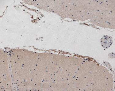 NPY2R Antibody - Anti-Mouse Neuropeptide Y receptor 2 staining (10 µg/ml) of a mouse cerebellum formalin-fixed, paraffin-embedded tissue section; seen at 20x magnification. Staining of isolated subarachnoideal cells with granular cytoplasm is observed.