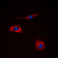 NPY2R Antibody - Immunofluorescent analysis of NPY2R staining in HeLa cells. Formalin-fixed cells were permeabilized with 0.1% Triton X-100 in TBS for 5-10 minutes and blocked with 3% BSA-PBS for 30 minutes at room temperature. Cells were probed with the primary antibody in 3% BSA-PBS and incubated overnight at 4 C in a humidified chamber. Cells were washed with PBST and incubated with a DyLight 594-conjugated secondary antibody (red) in PBS at room temperature in the dark. DAPI was used to stain the cell nuclei (blue).