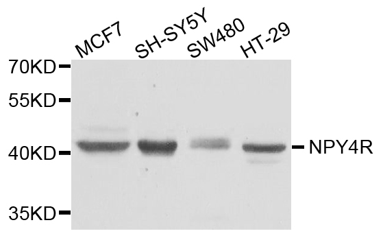 NPY4R / PPYR1 Antibody - Western blot analysis of extract of various cells.
