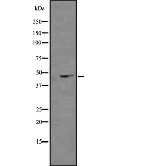 NPY4R / PPYR1 Antibody - Western blot analysis of NPY4R expression in K562 cells line lysates. The lane on the left is treated with the antigen-specific peptide.