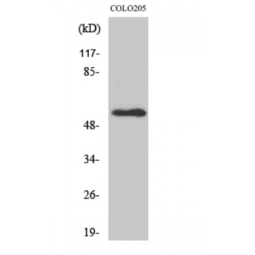 NPY5R Antibody - Western blot of NPY5-R antibody