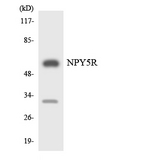 NPY5R Antibody - Western blot analysis of the lysates from Jurkat cells using NPY5R antibody.