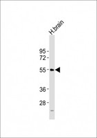 NPY5R Antibody - Anti-NPY5R Antibody at 1:2000 dilution + H. brain tissue lysates Lysates/proteins at 20 ug per lane. Secondary Goat Anti-Rabbit IgG, (H+L), Peroxidase conjugated at 1/10000 dilution Predicted band size : 51 kDa Blocking/Dilution buffer: 5% NFDM/TBST.