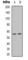 NPY5R Antibody - Western blot analysis of NPY5R expression in Jurkat (A); HepG2 (B) whole cell lysates.