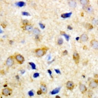 NPY5R Antibody - Immunohistochemical analysis of NPY5R staining in human brain formalin fixed paraffin embedded tissue section. The section was pre-treated using heat mediated antigen retrieval with sodium citrate buffer (pH 6.0). The section was then incubated with the antibody at room temperature and detected using an HRP polymer system. DAB was used as the chromogen. The section was then counterstained with hematoxylin and mounted with DPX.