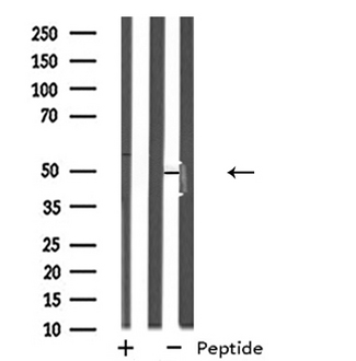 NPY5R Antibody - Western blot analysis of extracts of HepG2 cells using NPY5R antibody.