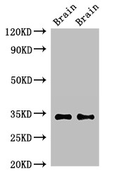 NPY6R Antibody - Positive WB detected in:Mouse brain tissue,Rat brain tissue;All lanes:NPY6R antibody at 2.3?g/ml;Secondary;Goat polyclonal to rabbit IgG at 1/50000 dilution;Predicted band size:34 KDa;Observed band size: 34 KDa;