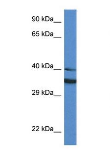 NQO1 Antibody - NQO1 antibody Western blot of HT1080 Cell lysate. Antibody concentration 1 ug/ml.  This image was taken for the unconjugated form of this product. Other forms have not been tested.