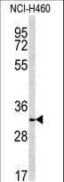 NQO1 Antibody - Western blot of NQO1 antibody in NCI-H460 cell line lysates (35 ug/lane). NQO1 (arrow) was detected using the purified antibody.