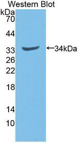 NQO1 Antibody - Western blot of NQO1 antibody.