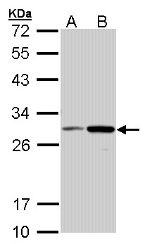 NQO1 Antibody - Sample (30 ug of whole cell lysate). A: Molt-4 , B: Raji. 12% SDS PAGE. NQO1 antibody diluted at 1:1000.