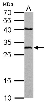 NQO1 Antibody - NQO1 antibody [C2C3], C-term detects NQO1 protein by Western blot analysis. A. 50 ug mouse heart lysate/extract. 12 % SDS-PAGE. NQO1 antibody [C2C3], C-term dilution:1:500