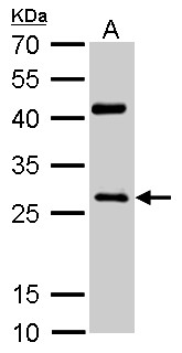 NQO1 Antibody - NQO1 antibody [C2C3], C-term detects NQO1 protein by Western blot analysis. A. 50 ug rat heart lysate/extract. 12 % SDS-PAGE. NQO1 antibody [C2C3], C-term dilution:1:500