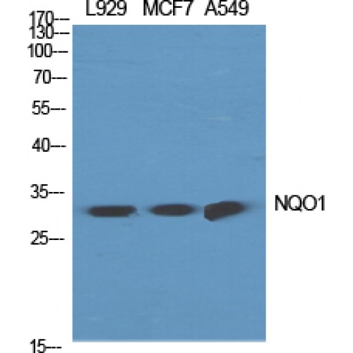 NQO1 Antibody - Western blot of NQO1 antibody