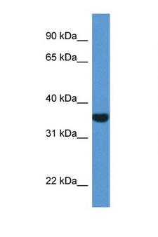 NQO1 Antibody - NQO1 antibody Western blot of 721_B Cell lysate. Antibody concentration 1 ug/ml.  This image was taken for the unconjugated form of this product. Other forms have not been tested.