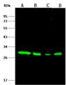 NQO1 Antibody - Anti-NQO1 rabbit monoclonal antibody at 1:500 dilution. Lane A: A549 Whole Cell Lysate. Lane B: MCF7 Whole Cell Lysate. Lane C: Raji Whole Cell Lysate. Lane D: HepG2 Whole Cell Lysate. Lysates/proteins at 30 ug per lane. Secondary: Goat Anti-Rabbit IgG (H+L)/HRP at 1/10000 dilution. Developed using the ECL technique. Performed under reducing conditions. Predicted band size: 31 kDa. Observed band size: 31 kDa.
