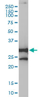 NQO1 Antibody - NQO1 monoclonal antibody (M01), clone 1E3-A6 Western Blot analysis of NQO1 expression in HepG2.