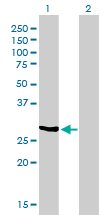 NQO1 Antibody - Western Blot analysis of NQO1 expression in transfected 293T cell line by NQO1 monoclonal antibody (M01), clone 1E3-A6.Lane 1: NQO1 transfected lysate(30.9 KDa).Lane 2: Non-transfected lysate.